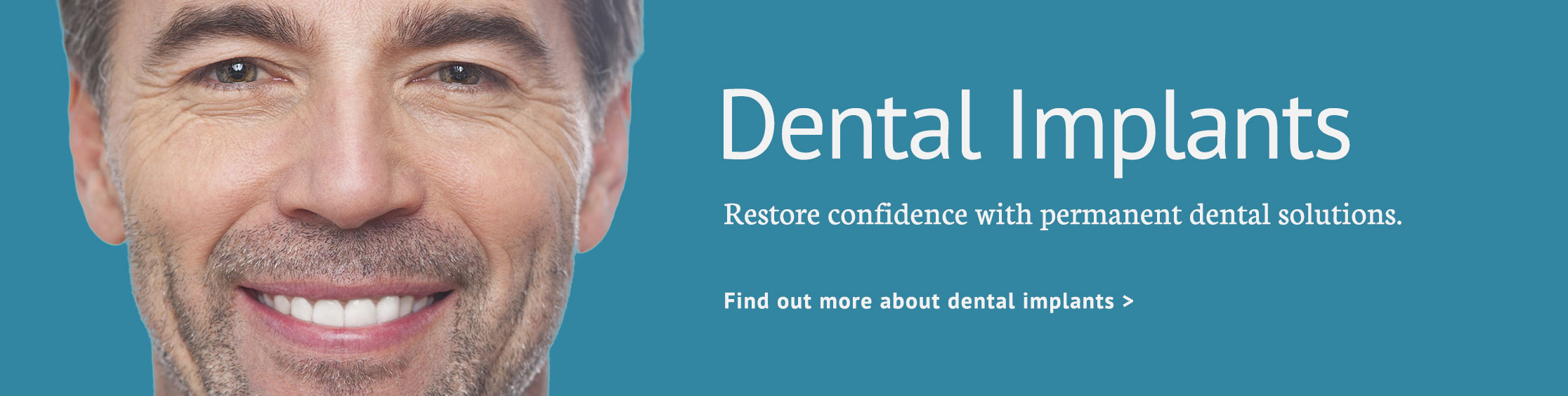 Dental Implants